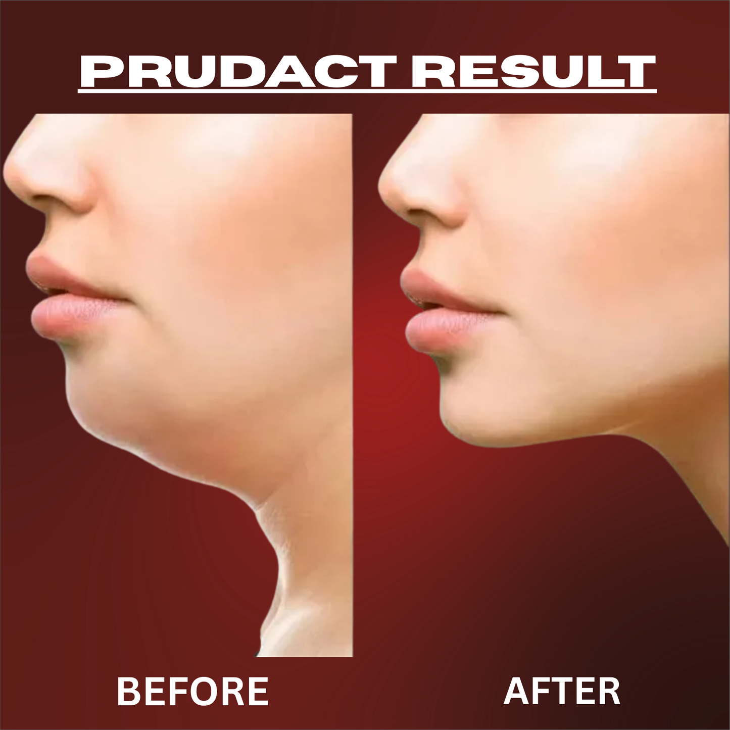 Jaw Exerciser