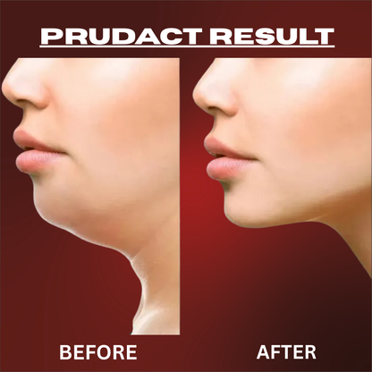 Jaw Exerciser